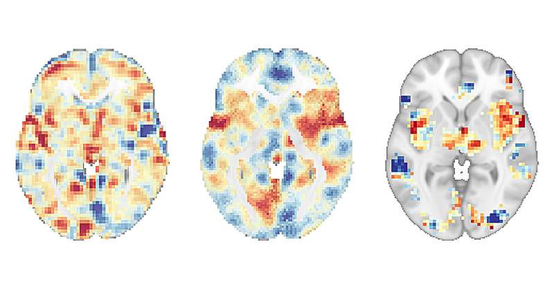 Researchers at UC San Diego Study Pain-Reducing Effects of Mindfulness Meditation